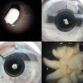 Coconut mass propagation attained through somatic embryogenesis 3